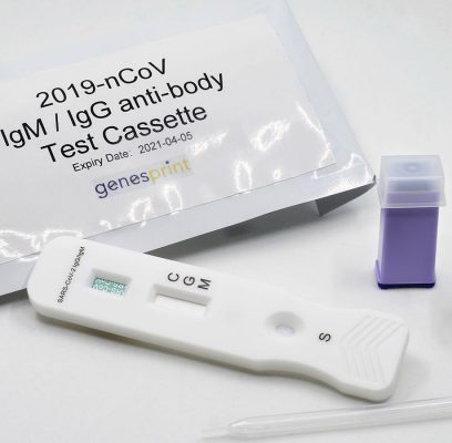 COVID-19 IgM/IgG Rapid Test