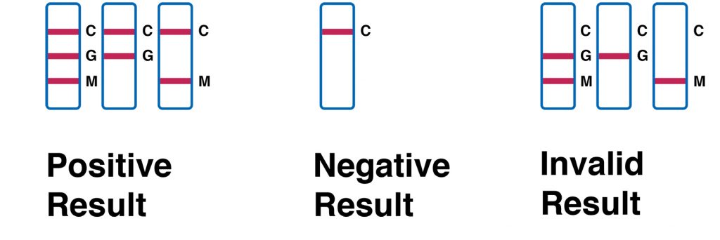 Antibody Test Results